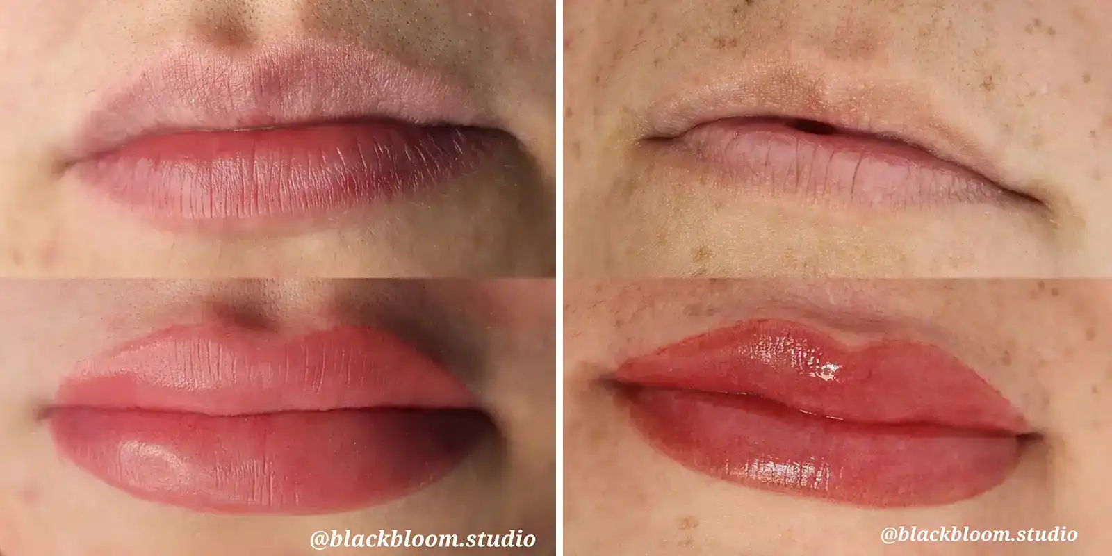 How Long Does Lip Blushing Last?