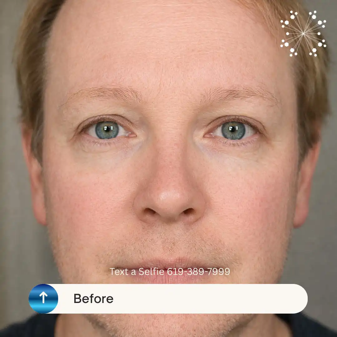 Digital Pre-Draw Men's Brows - Before