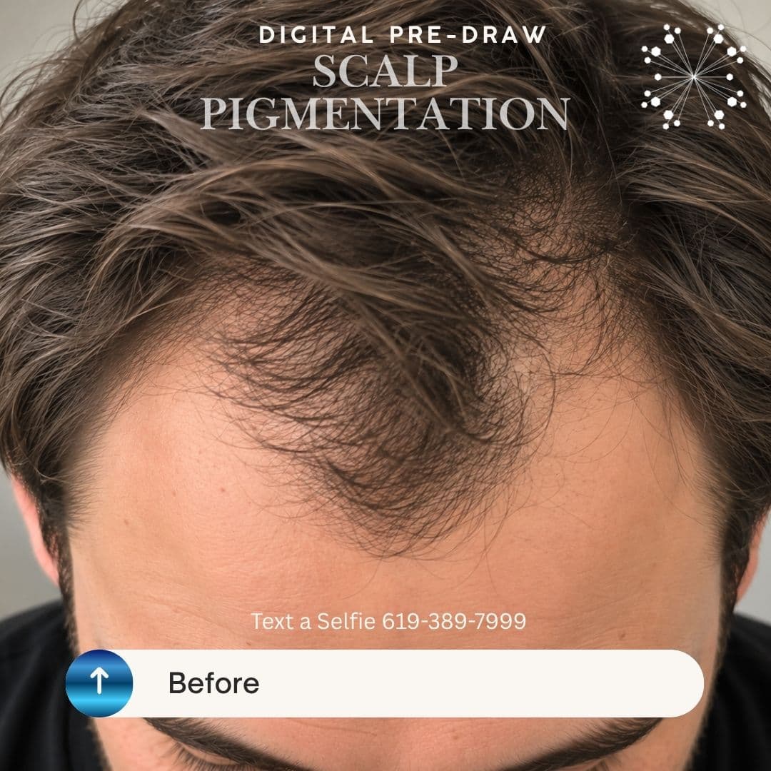 DIGITAL PRE-DRAW SCALP PIGMENTATION PREVIEW